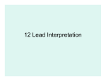 12 Lead Interpretation - Sunnybrook Centre For Prehospital Medicine