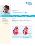 Restrictive Cardiomyopathy (RCM)