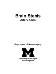 Brain Stents - Michigan Medicine