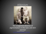 Albinism - andoverhighanatomy