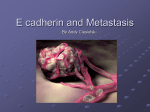 E cadherin and Metastasis