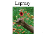 Leprosy Powerpoint