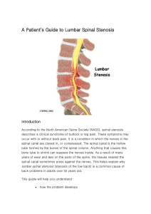 A Patient`s Guide to Lumbar Spinal Stenosis
