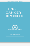 Understanding Lung Cancer Biopsies