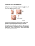 lumpectomy and partial mastectomy