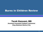 Burns in Children
