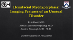 Hemifacial Myohyperplasia: Imaging Features of an
