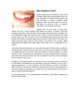Why Straighten Teeth?