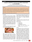 surgical removal of palatal bony exostosis: a case report