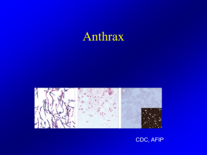 Anthrax - sciencenglish