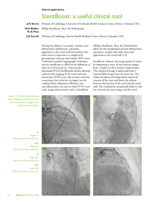 StentBoost: a useful clinical tool