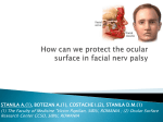 exposure keratopathy in facial nerve palsy