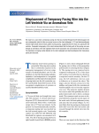 Misplacement of Temporary Pacing Wire into the Left Ventricle Via