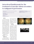 Intravitreal Ranibizumab for the treatment of macular edema