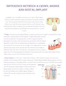 Difference between a crown, briDge anD Dental implant