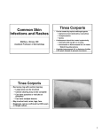 Common Skin Infections and Rashes Tinea Corporis