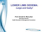 LOWER LIMB OEDEMA: