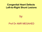 Congenital Heart Defects Left-to-Right Shunt Lesions by Prof Dr