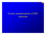 Ocular manifestations of HIV infection