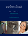 Laser Trabeculoplasty - David Richardson, MD