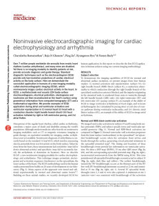 Noninvasive electrocardiographic imaging for cardiac