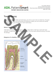 ADA Patient Smart | Tooth Decay
