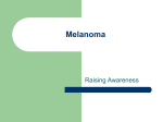 Melanoma - Kate`s Foundation for Melanoma Awareness and