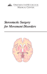 Stereotactic Surgery for Movement Disorders - Dartmouth