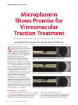 Microplasmin Shows Promise for Vitreomacular Traction Treatment