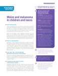 Moles and melanoma in children and teens