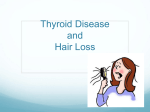 Thyroid Disease and Hair Loss