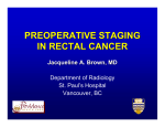 preoperative staging in rectal cancer