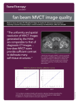 fan beam MVCT image quality
