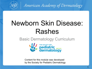 Newborn Skin Disease: Rashes - American Academy of Dermatology