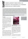 Caliber persitent labial artery: an unknown vascular lesion or a