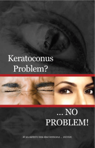 Keratoconus Problem? … NO PROBLEM!