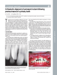 Orthodontic alignment of permanent incisors following previous