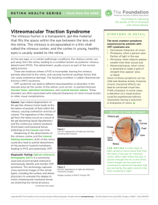 Vitreomacular Traction Syndrome - The American Society of Retina