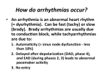 How do arrhythmias occur? - Anesthesiology, Pharmacology and