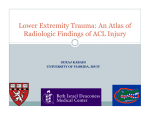 Lower Extremity Trauma: An Atlas of Radiologic Findings of ACL Injury