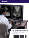 The Use of Breast Tomosynthesis in a Clinical Setting