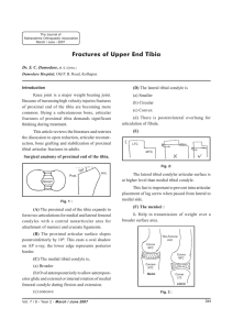 Fractures of Upper End Tibia - Journal of Trauma and Orthopaedics