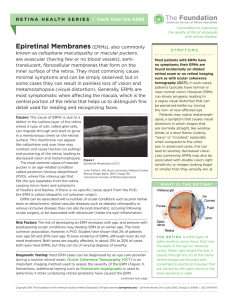 Epiretinal Membranes (ERMs), also commonly