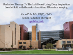 Radiation Therapy to the left breast using Deep Inspiration Breath