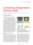 Correcting Astigmatism During LASIK