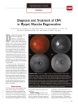 Diagnosis and Treatment of CNV in Myopic Macular Degeneration
