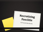 Necrotizing Fasciitis - Local.brookings.k12.sd.us