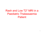 (mg/kg/d) Serum Ferritin (ng/mL)