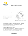 Intravitreal Injections - Michigan Medicine