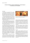 Persistent Unilateral Conjunctival Inflammation as the First Sign of